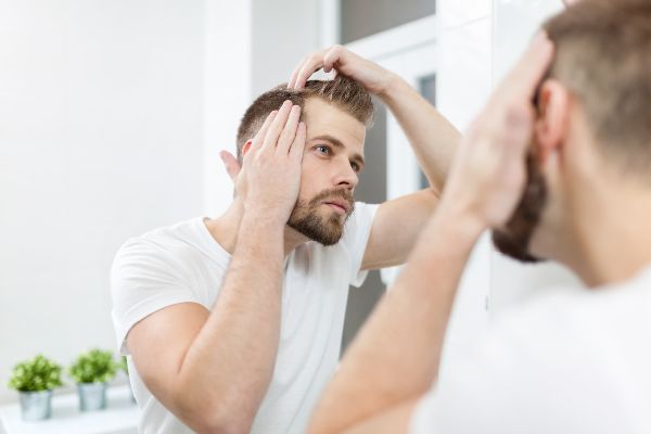 Minoxidil oral; imagen donde se muestra a un hombre preocupado por la apresurada pérdida de cabello